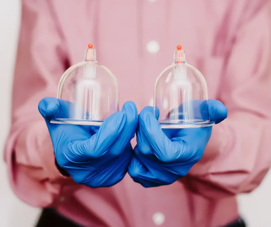 أفضل أيام الحجامة في شهر ابريل 2025 بالتوقيت الميلادي والهجري