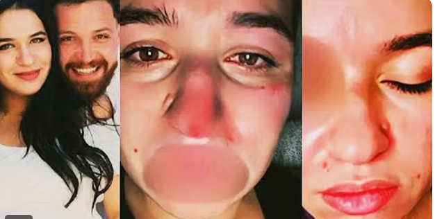 فضيحة محمود حجازي في الفندق